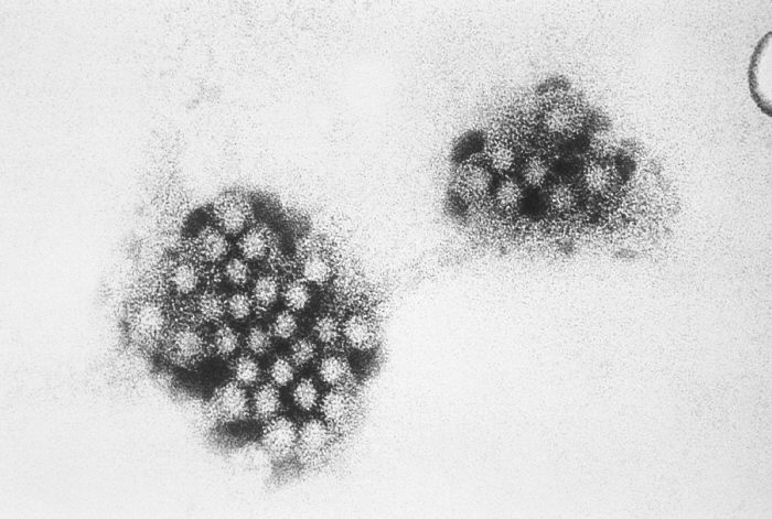 Norwalk virus