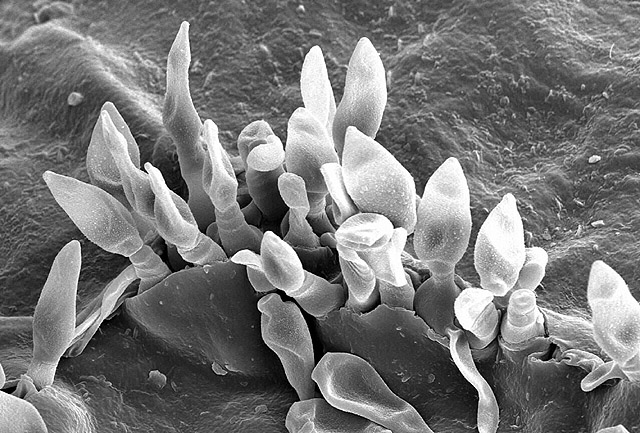 Dothideomycetes