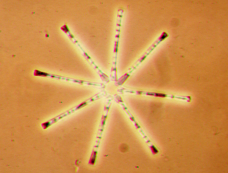 Asterionella