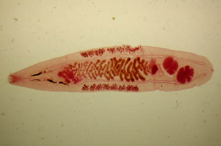 Opisthorchis