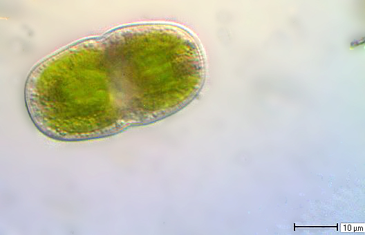 Actinotaenium