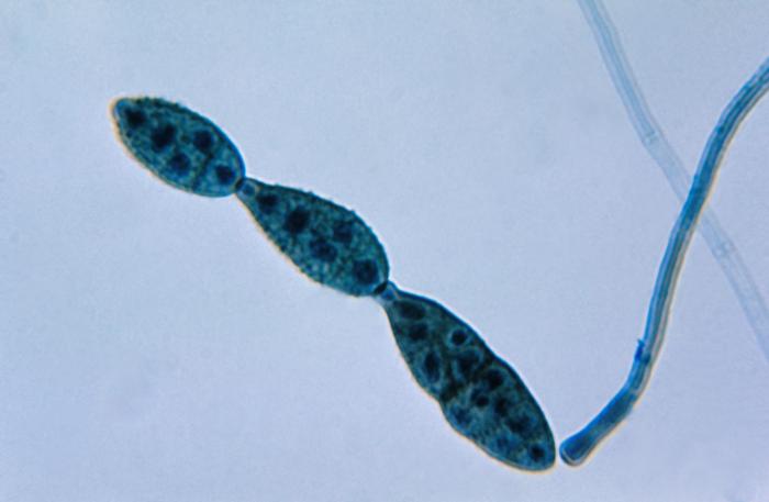 Alternaria