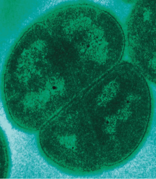Deinococcus-Thermus
