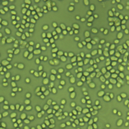 Candida glabrata