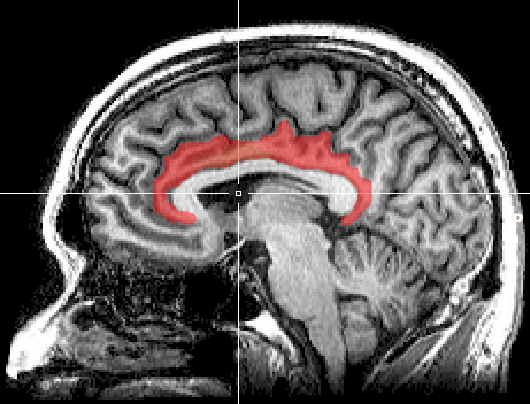 cingulate gyrus