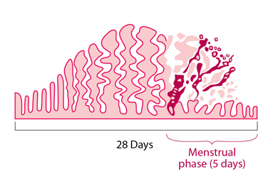 menstrual disorder