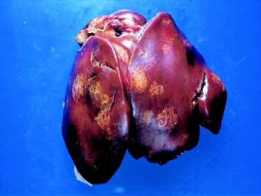 histomoniasis