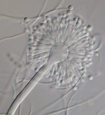 Aspergillus versicolor