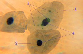 Chlamydophila pneumoniae