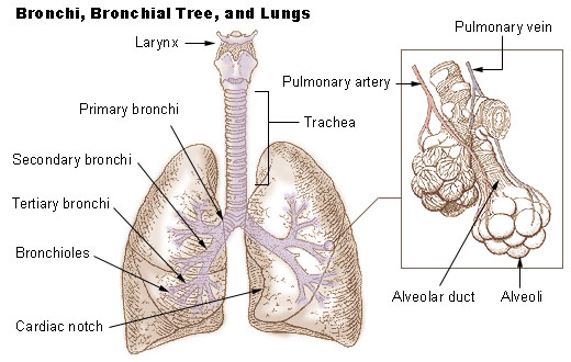 bronchiectasis