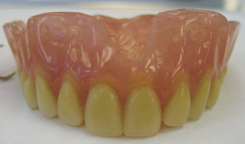 dentures