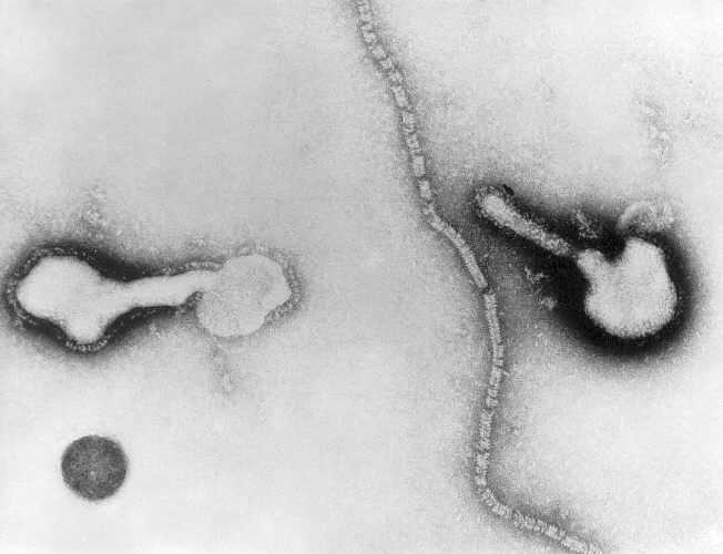 human parainfluenza