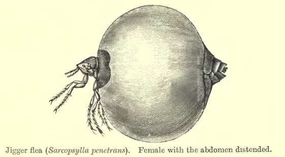 tungiasis