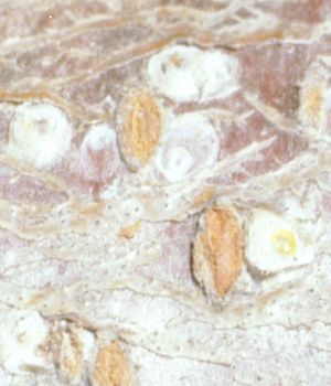 Pseudaulacaspis pentagona