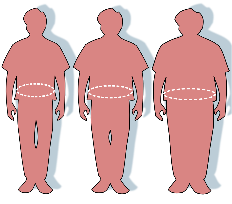 obesity