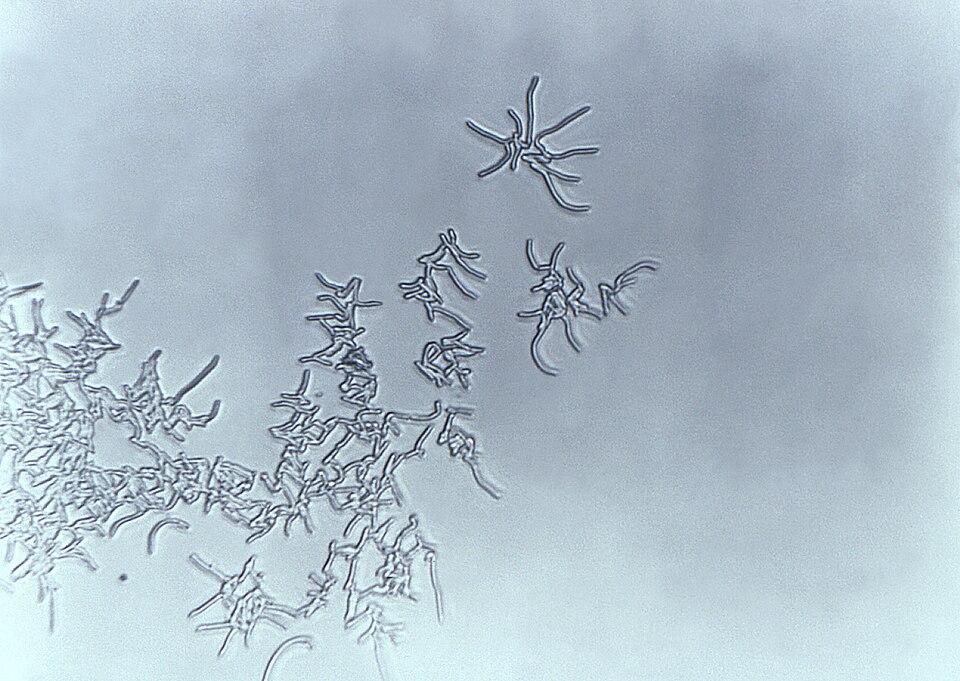 Rhodococcus