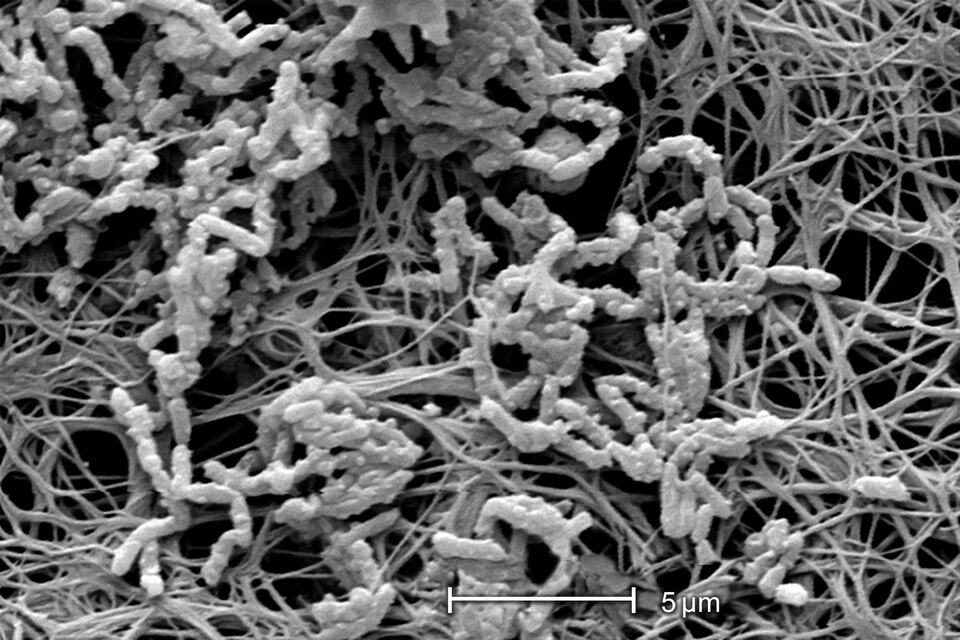 Achromobacter