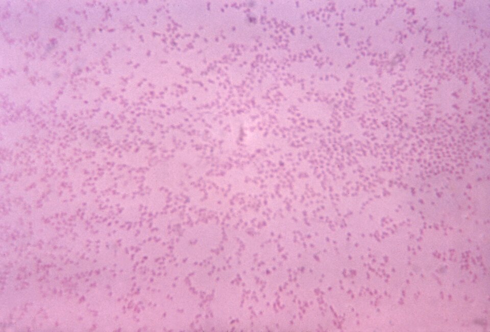 Pasteurella
