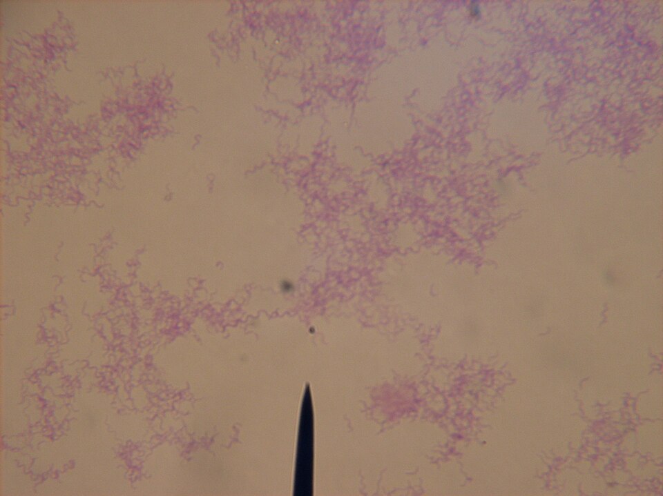 Rhodospirillum rubrum