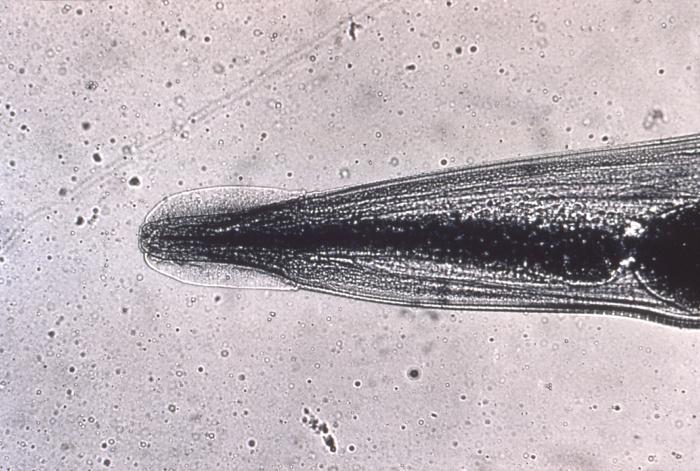 enterobiasis