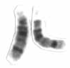 human chromosome 14